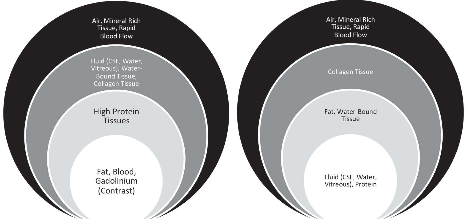 Fig. 4. Radiologists often use bone window settings to improve bony detail when evaluating conditions such as suspected orbital fractures or bony erosion from metastatic tumors.