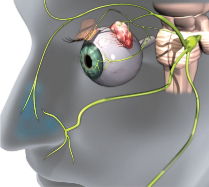 Fig. 1. Efferent parasympathetic nerves innervate the LFU. The 0.1% dose of the OC-01 nAChR agonist nasal spray that targets these nerves led to a statistically significant improvement in dry eye symptoms.