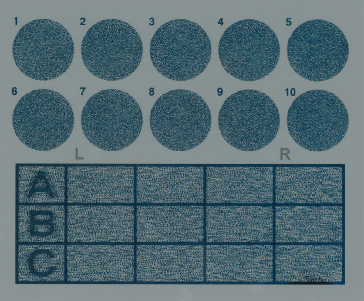 Fig. 3. Wirt circles with random dot background.