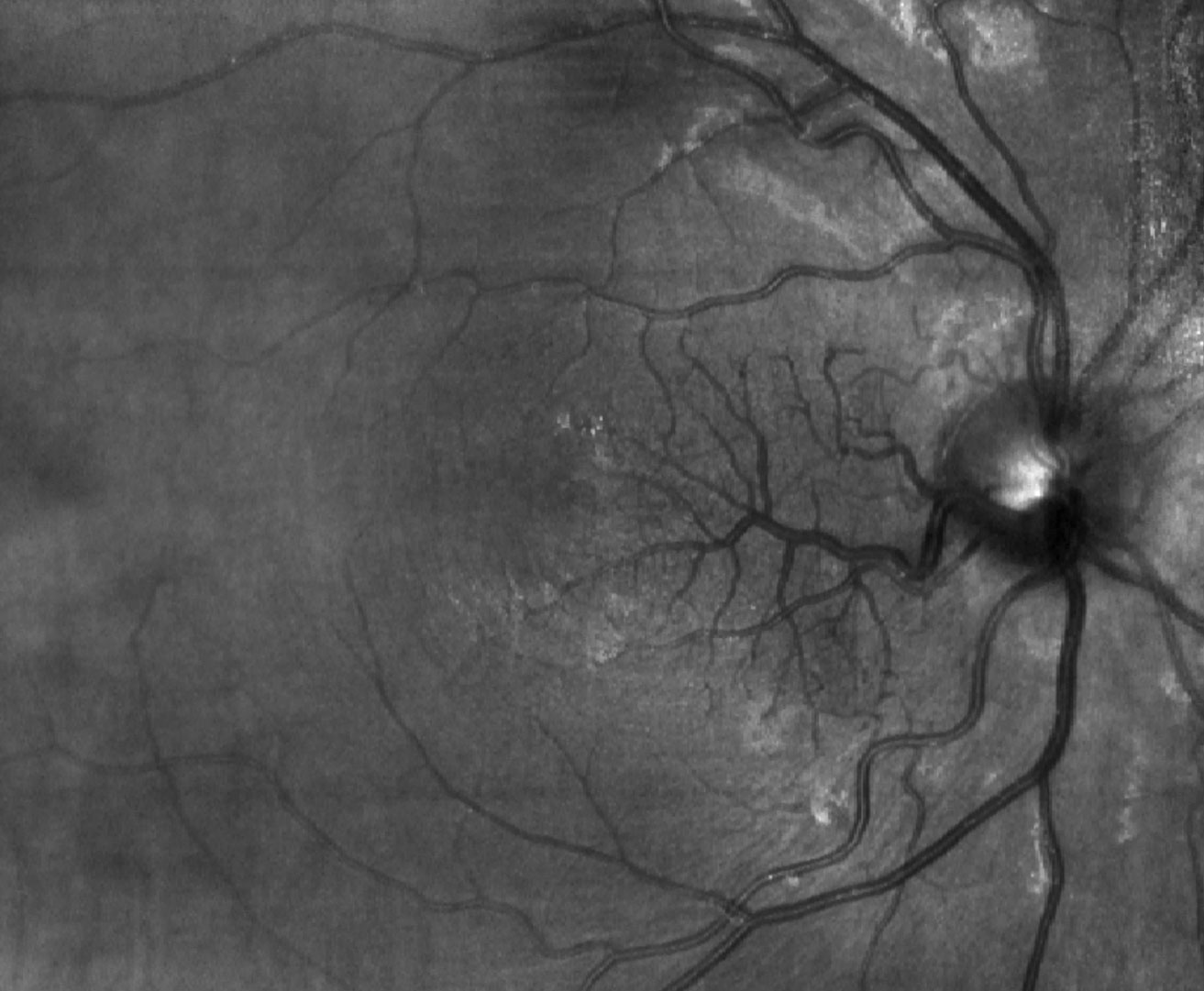 Can you identify the patient’s condition based off this image?