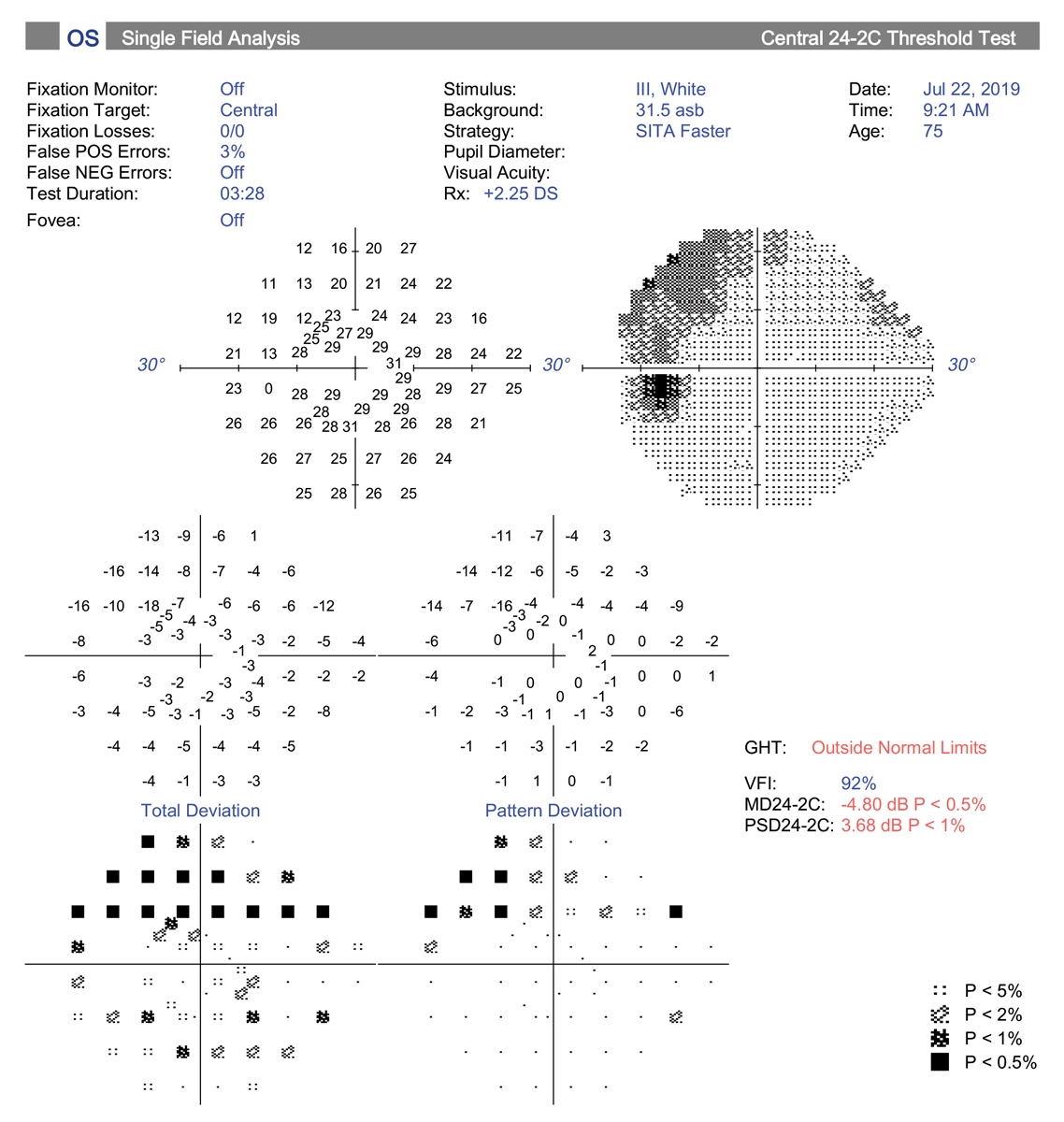 The central 24-2C test pattern incorporates the new SITA-Faster testing strategy along with 10 extra test locations to the traditional 24-2 grid pattern. This has the potential to replace the 10-2 test for central field testing.