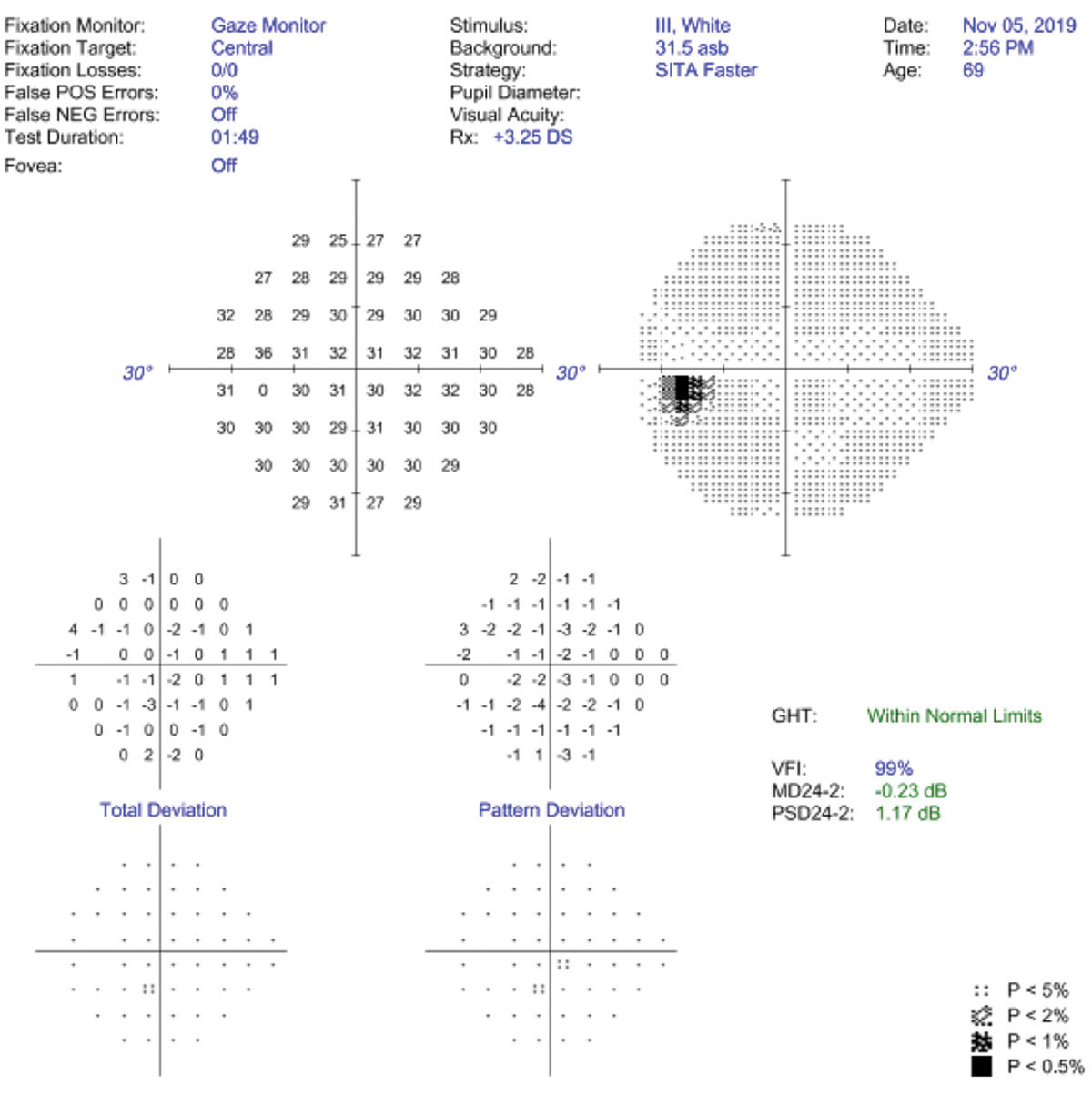 False positives and gaze tracking are the best ways to assess VF reliability.