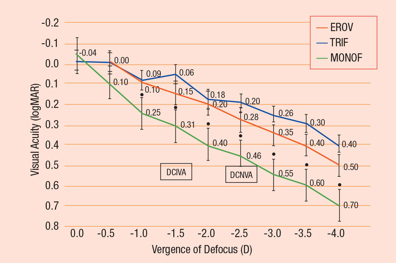 Mean binocular visual acuity with correction for distance vision measured four months postoperatively through three different IOLs: the Alcon PanOptix (blue), the J&J Symfony (red) and the Alcon monofocal AcrySof SN60WF (green). The PanOptix demonstrates peaks at plano, -1.50 and -2.50.