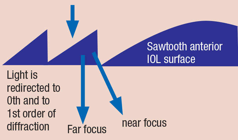 The phase shift induced by a diffractive step is equal to half a wavelength, which deflects the wavefront towards a single focus, the first diffraction order. Some light passes through undeflected: the zero order of diffraction. For clarity, higher orders of diffraction are not shown.