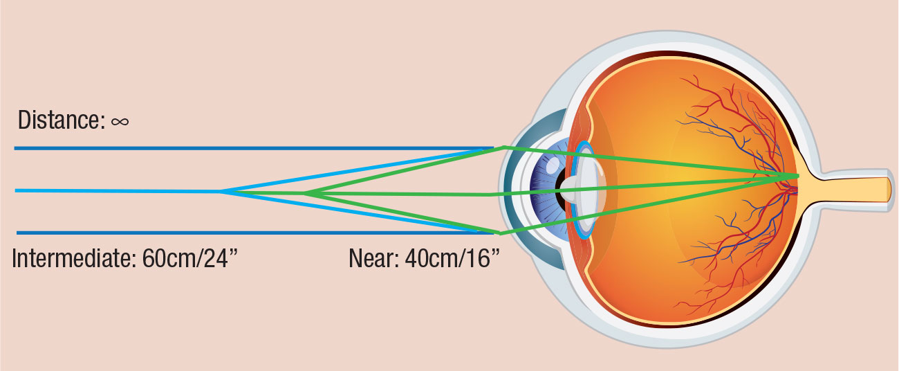 PanOptix is designed for three focal points: plano (distance), intermediate (60cm, or 24”), and near (40cm, or 16”).