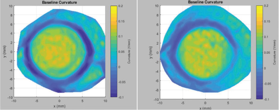 Curvature maps of a patient’s sclera just after (left) soft disposable lens removal and 24 hours later. 