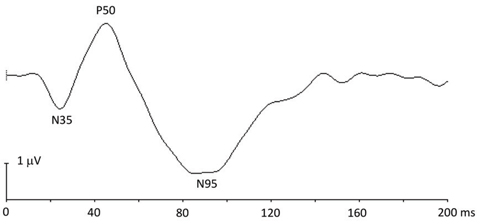 pERG was able to measure ocular parameters as accurately as OCT in this study. Photo: Hua Bi, OD, PhD.