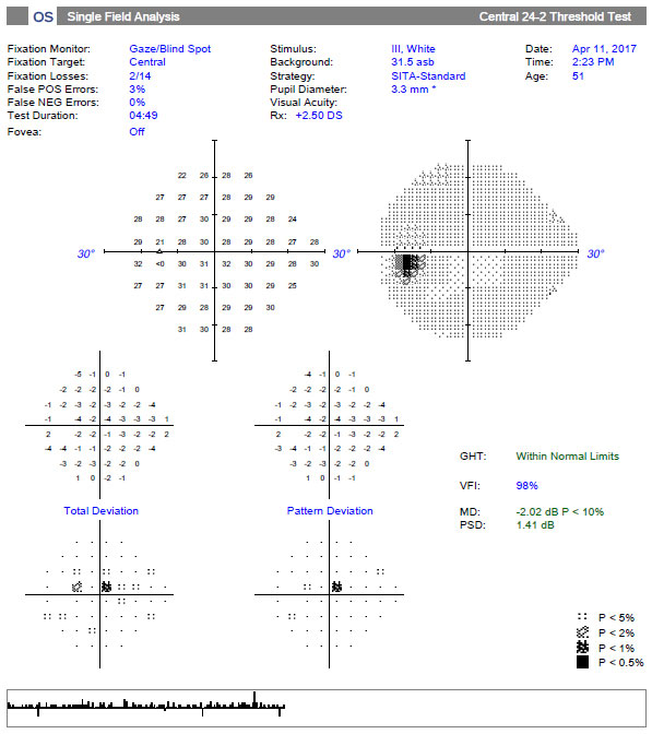 Patient-centric communication could help improve eye care providers' understanding of visual impairment degree and visual field damage. Photo: Danica Marrelli, OD.