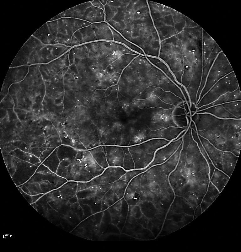 This screening technique for DR patients helped determine when follow-up was needed. 