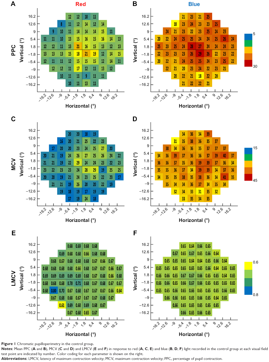 The new technology of objective pupil light reflex testing, shown here in a study of Best vitelliform macular dystrophy, reveals new ocular manifestations of Alzheimer’s that could prove clinically useful in the future.