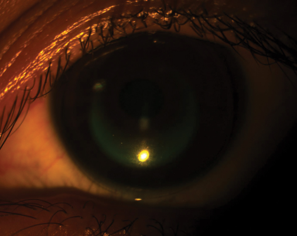 An increase in the eyecare workforce is required for the ongoing provision of myopia treatments, such as ortho-K, at thresholds of 0.50 D and 0.25 D/year, respectively.