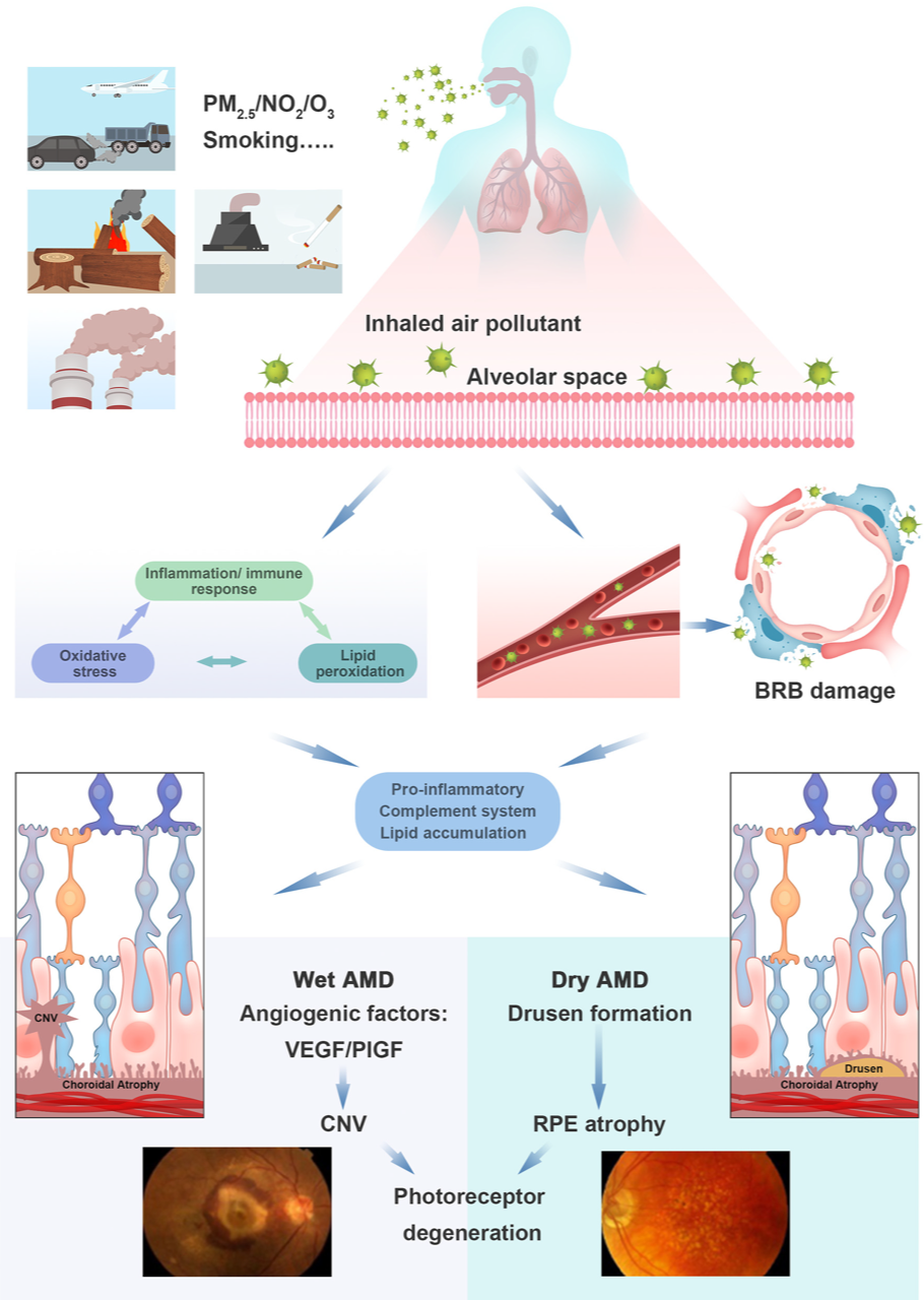 As air pollutants exposure enter the blood circulation and cross the blood-retinal barrier, they can cause the pathological changes of AMD. Exposure can also cause local inflammatory responses and oxidative stress responses, which in turn cause systemic responses that act on the macula.