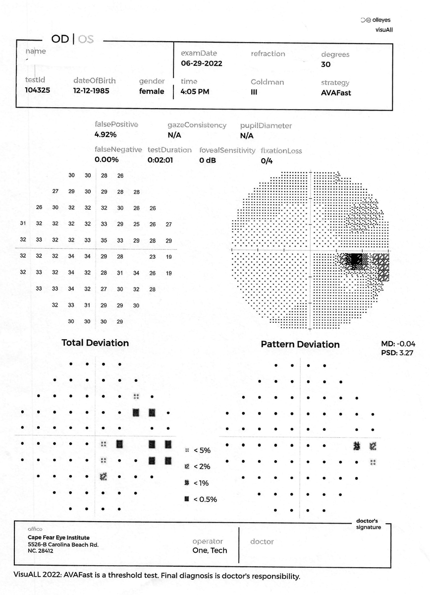 The printout from the VisuAll unit is laid out exactly the same as an HFA printout to ease the transition to the new platform.