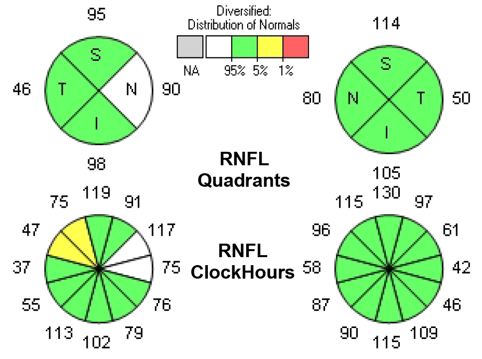 Normative references for OCT and OCT-A fail to reflect population-specific differences.