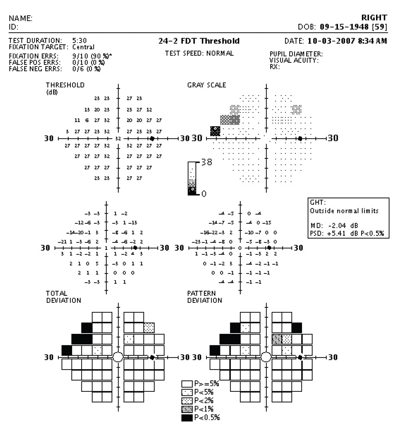 Variability of standard automated perimetry increases in areas of glaucomatous loss.