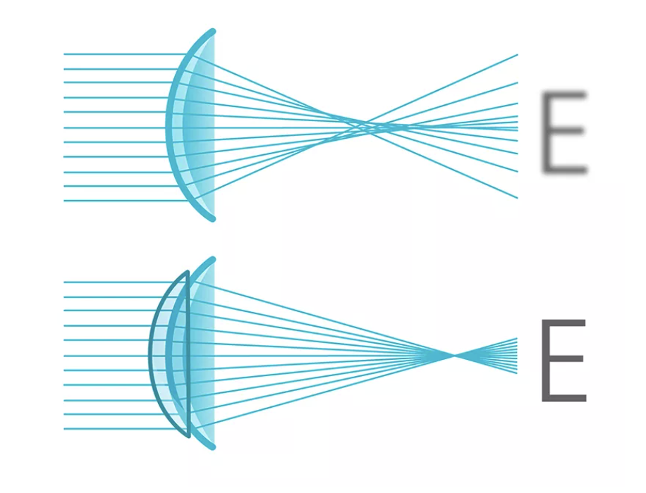 The “aberration neutralizing system” used in some of CooperVision’s spherical lenses converges light rays to produce a single point of focus, as illustrated here.