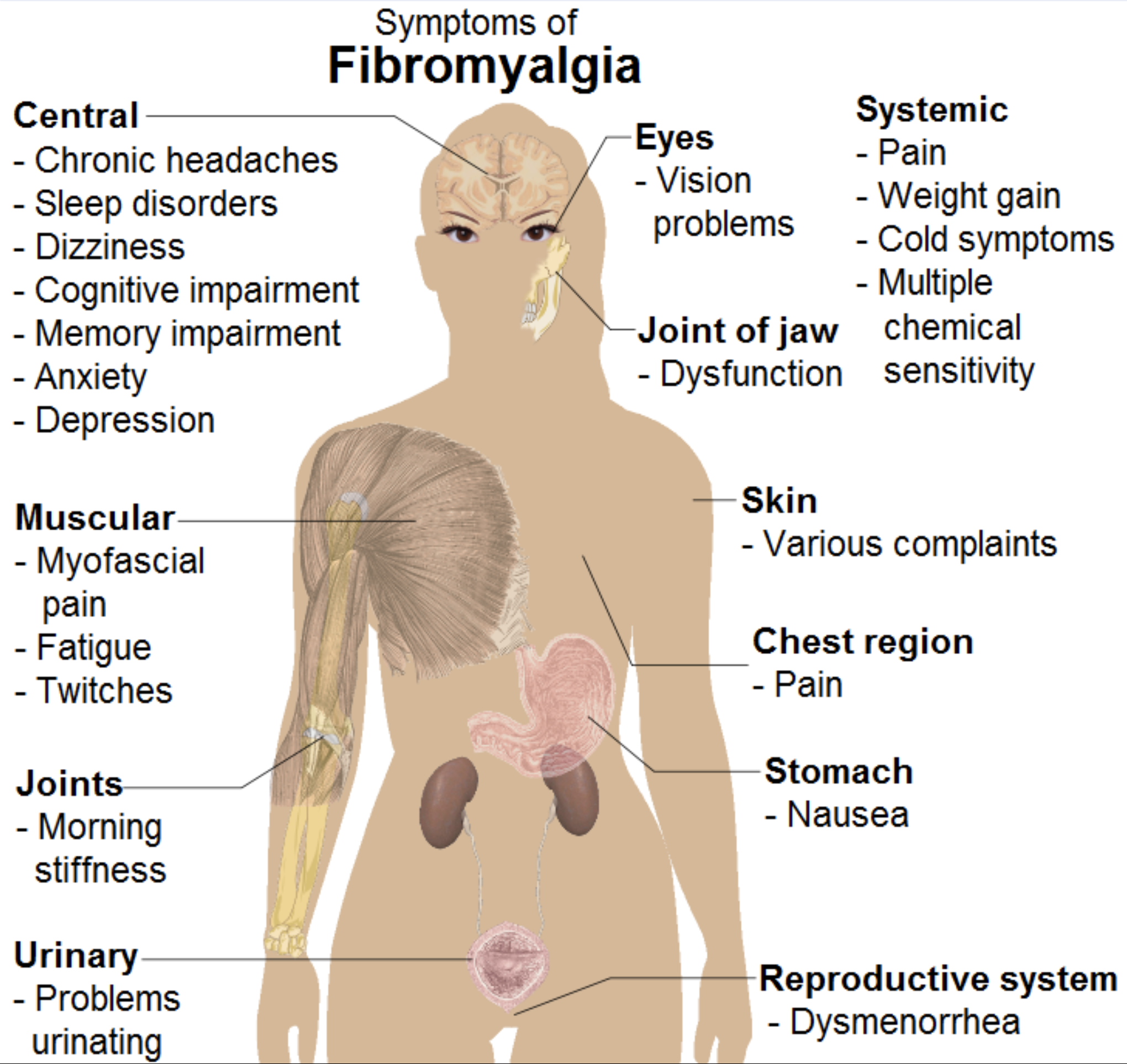 Spectralis OCT was able to effectively differentiate between healthy patients and those with FM.