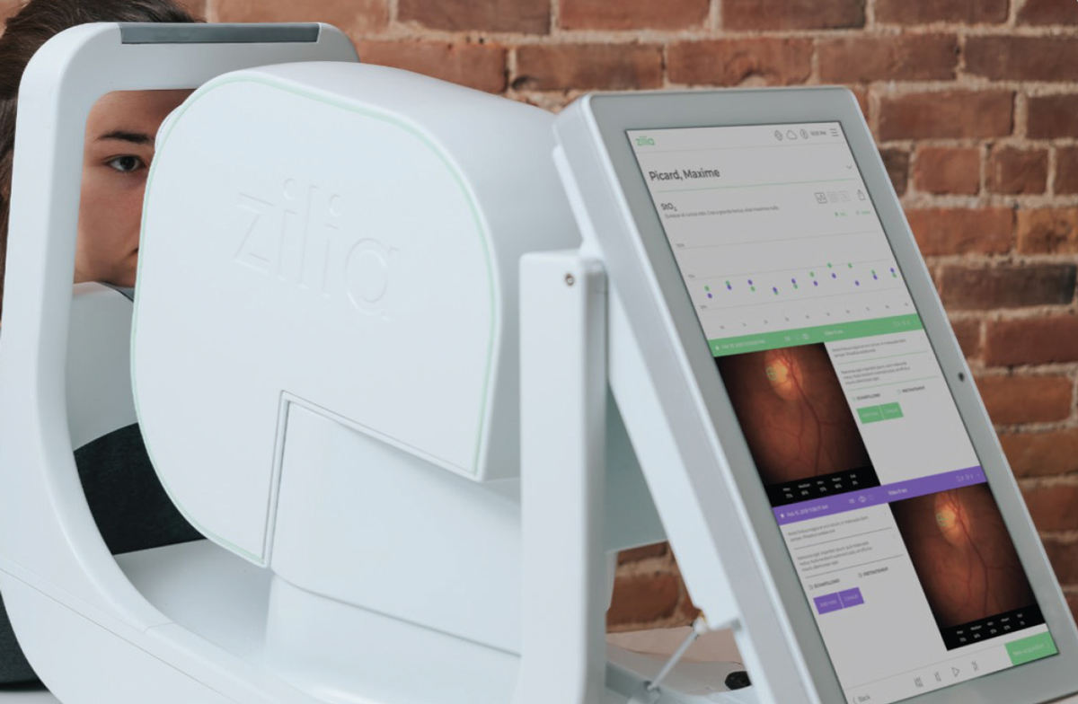 Zilia has a hybrid retinal camera in development that can potentially incorporate oximetry, a measurement of blood oxygen saturation. 