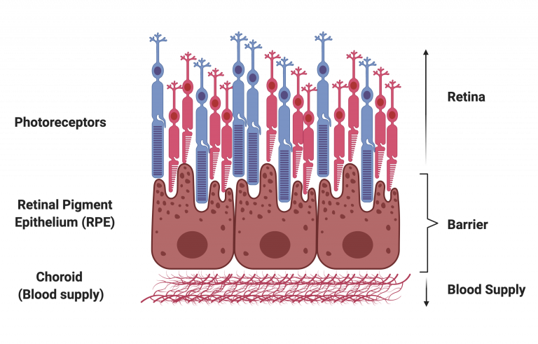 Damage to the blood-retinal barrier is present in both diabetic retinopathy and several forms of dementia, likely leading to the association found in this study.