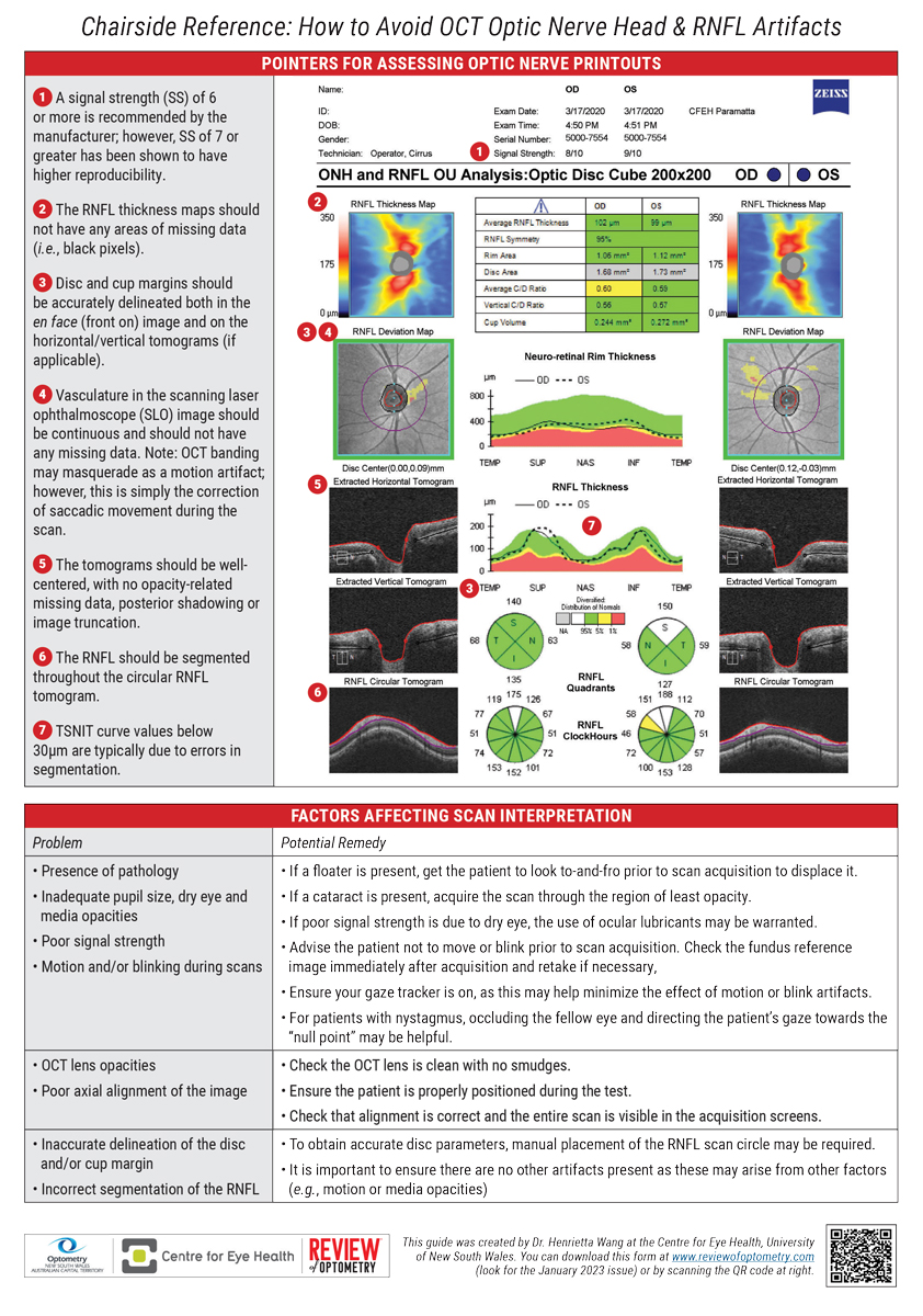 Chairside Reference: How to Avoid OCT Optic Nerve Head & RNFL Artifacts Guide by Henrietta Wang, BOptom (Hons), BSC, MPH