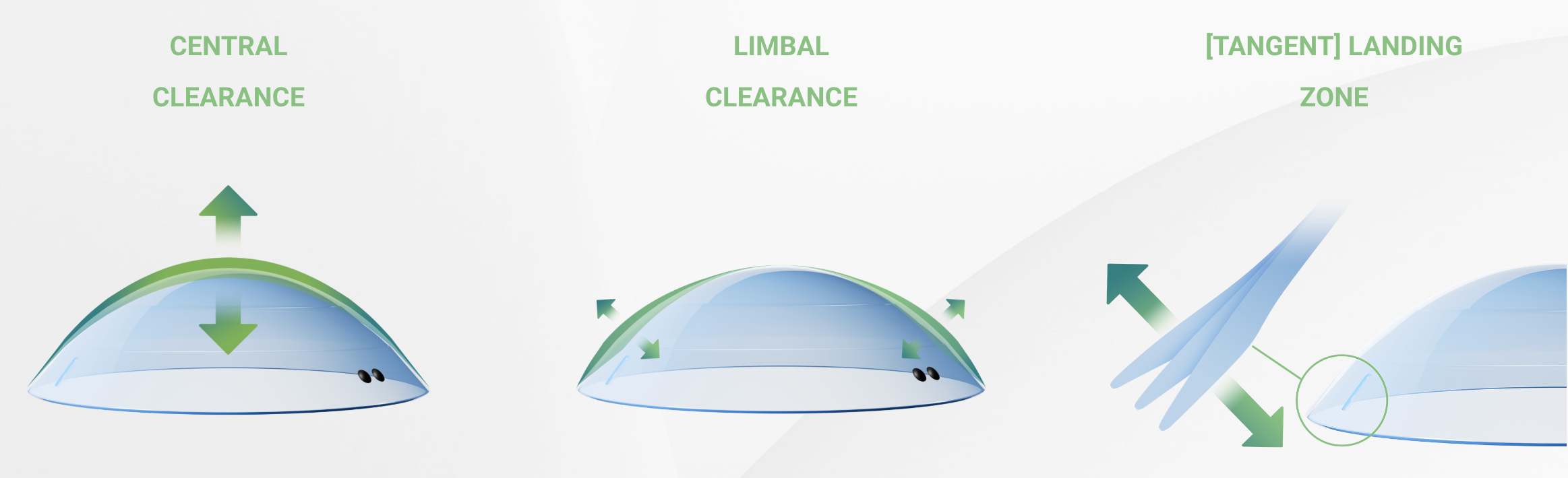 An illustration of the three zones in new Europa Tangent scleral lenses.