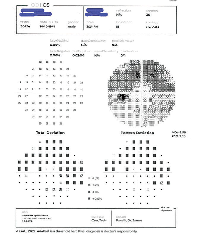 The visual field defect seen in the patient’s left eye.