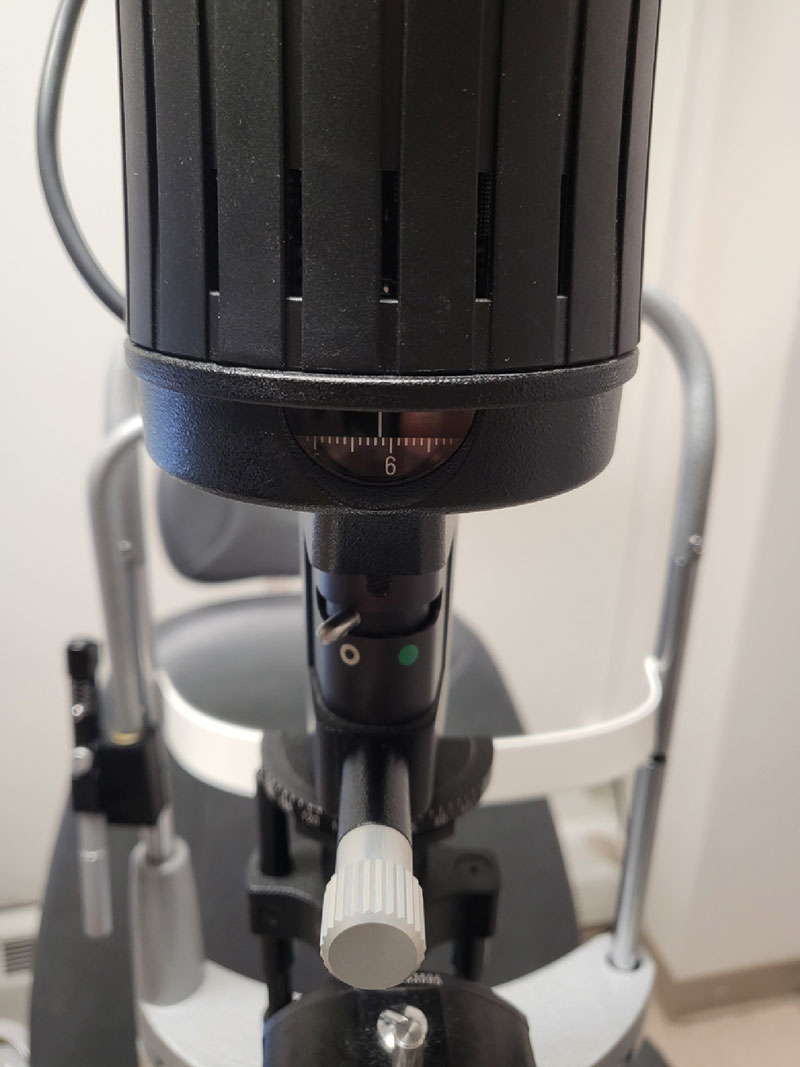 Fig. 4. Use the calipers on your slit lamp beam to measure.