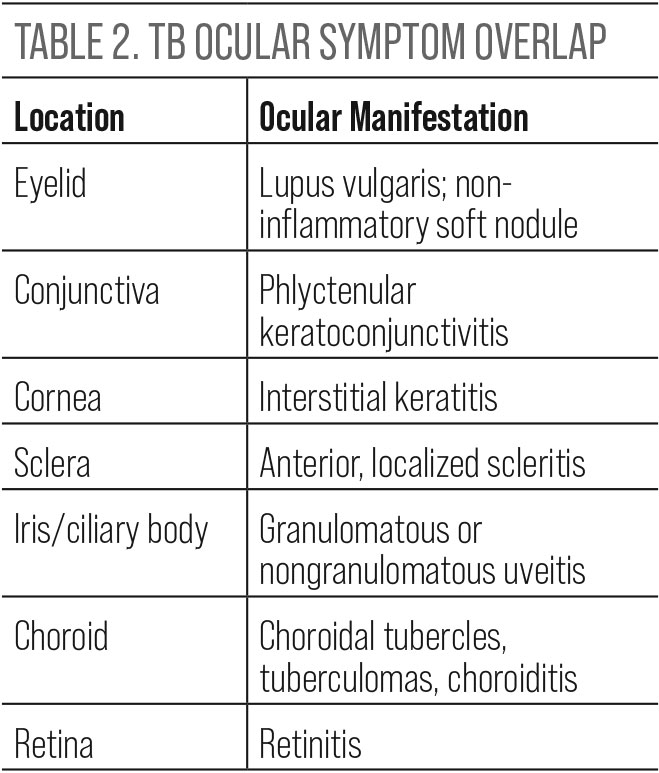 Table 2.