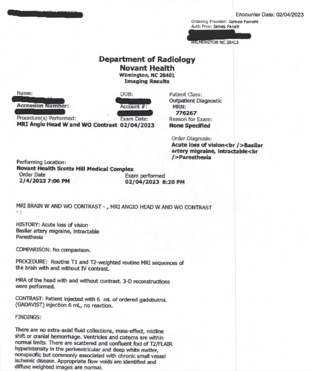 Fig. 7. This is the typical radiology report you will see when ordering neuroimaging. In this case, both and MRI and an MRA were ordered. This first page is the report pertaining to the MRI. The MRA was entirely normal. Note here that as the findings are clearly laid out, it is incumbent upon the ordering provider to understand what these findings mean and ultimately to develop a plan related to these findings. Given these are consistent with small vessel ischemic disease, referral to internal medicine is warranted to mitigate the risks of continued atherosclerosis. While the initial symptoms initiated the MRI and MRA ordering, fortunately the patient did not require emergent or urgent treatment.