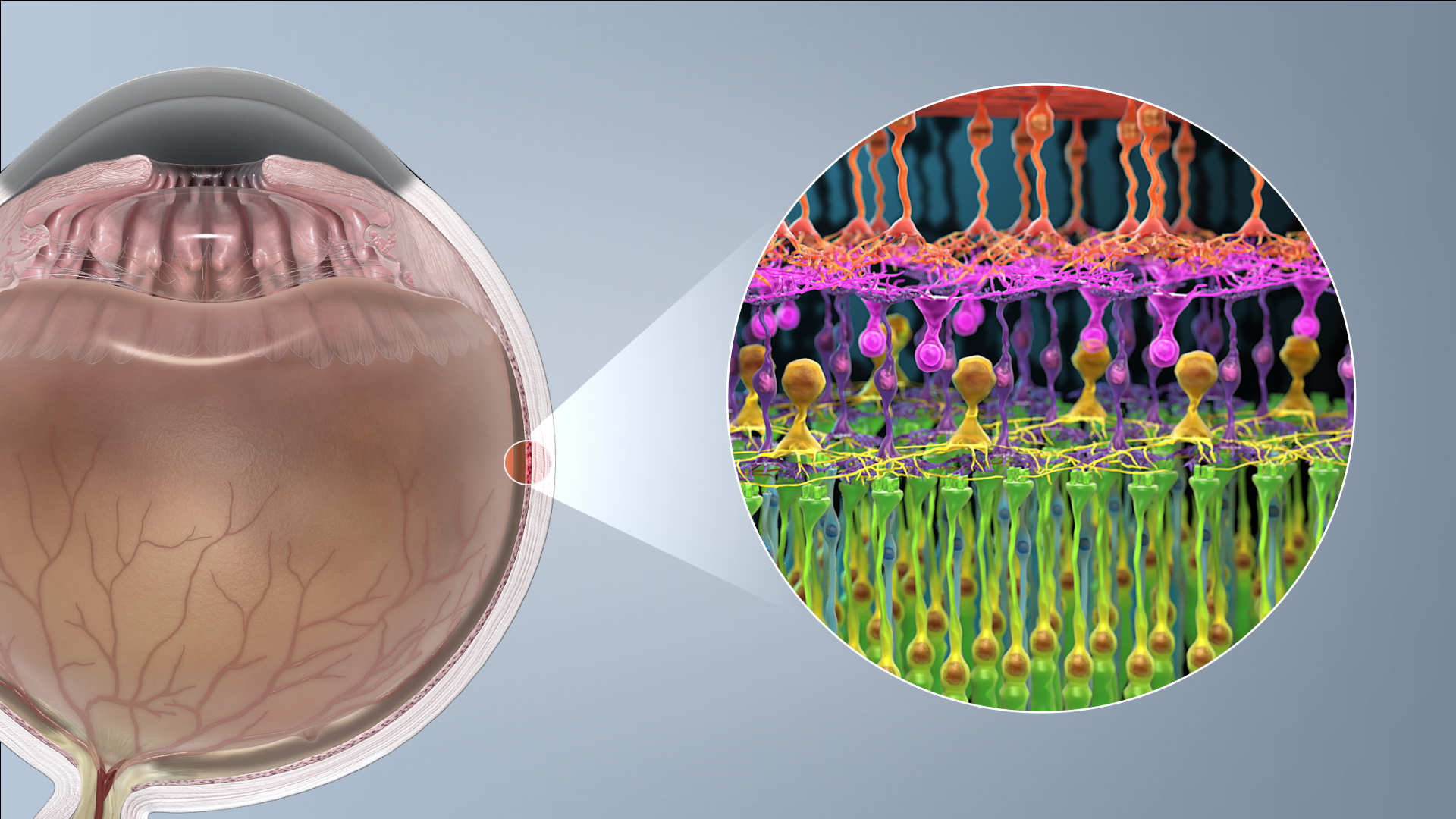 Lower photoreceptor outer densities and spacing found in patients with multiple sclerosis, suggest that adaptive optics retinal imaging has the potential to become a sensitive marker for this disease.