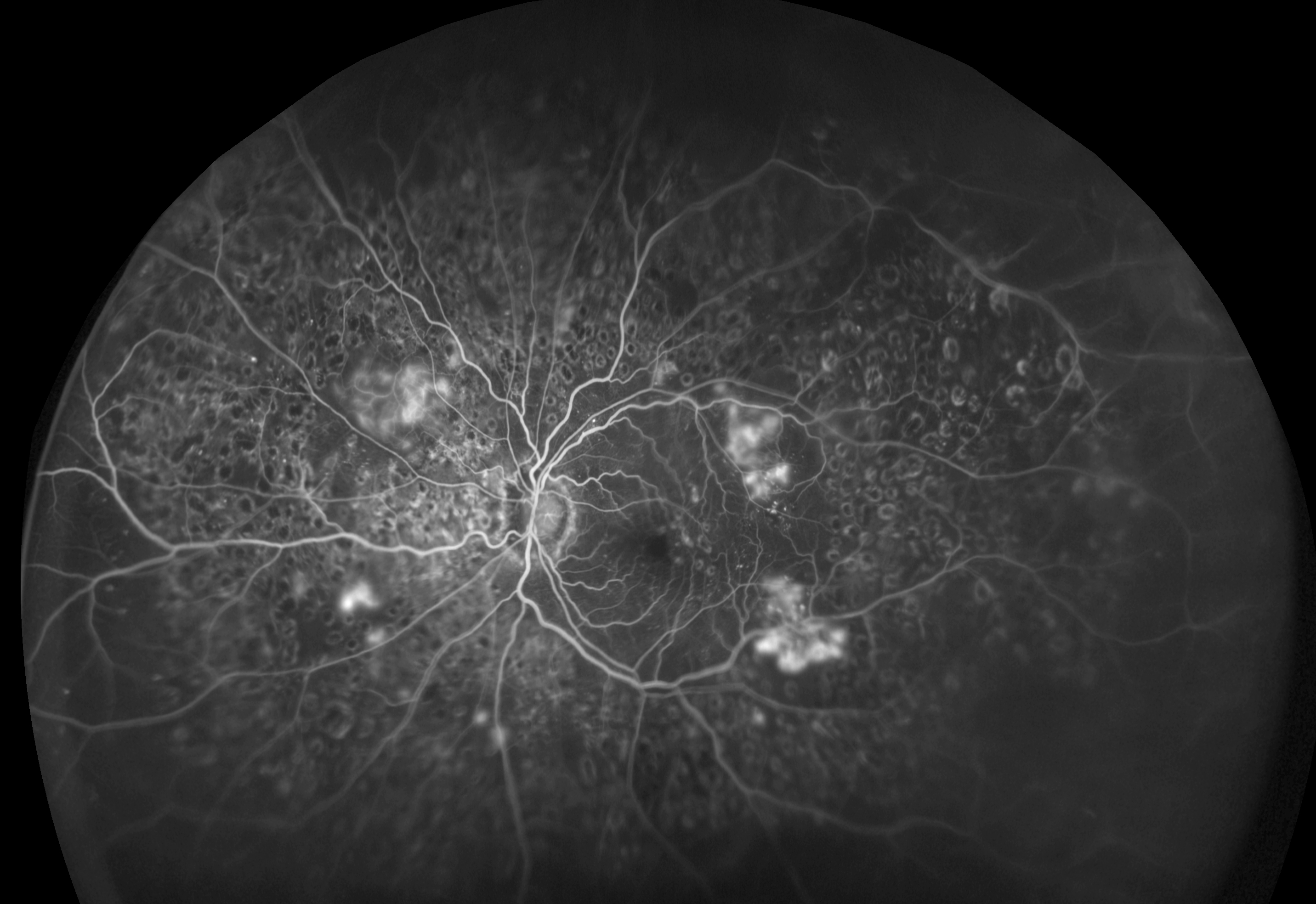 Over five years, only 4% of 80-year-olds and 2.4% of 85-year-olds in this study were referred to a hospital eye clinic for DR, and less than 1% of received treatment.