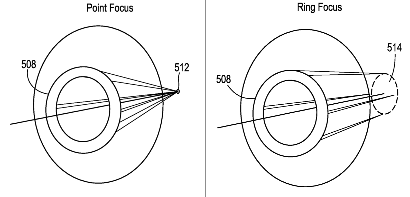 Teenagers were more judgmental of their overall vision with certain myopia control soft contact lenses compared with children between the ages of seven and 12.