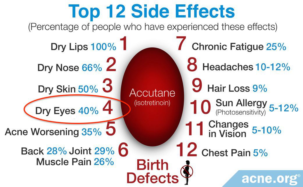 The ocular adverse effects of isotretinoin largely ceased after treatment stopped, leading study authors to speculate that there may be some sort of meibomian gland regeneration process that could benefit patients suffering from meibomian gland dysfunction.