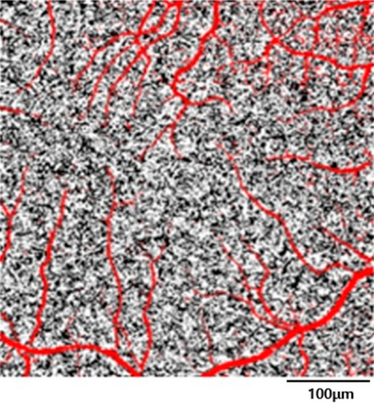 Swept-source OCT-A found that blood flow in the kidneys was positively correlated with peripapillary vessel density and negatively correlated with choriocapillaris flow void density percentage, independent of age and other potential confounding factors.