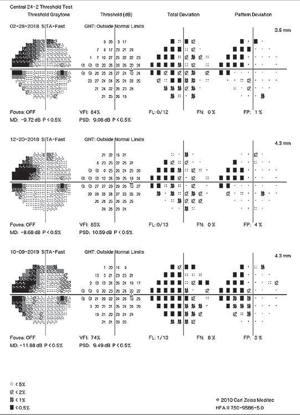 Authors of a recent study advocate for better metrics to track and anticipate central visual field loss, owing to the high rate of progression seen in their research.