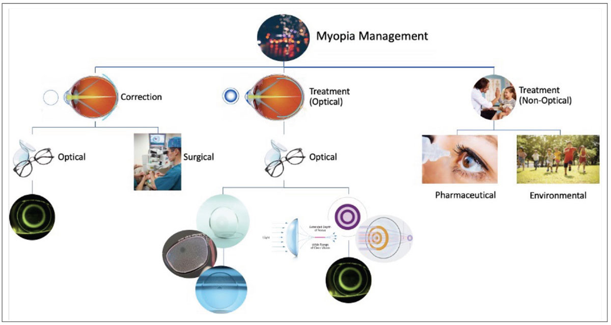 Fig. 3. This flowchart of possibilities for myopia management can help parents appreciate what options are available for each route.