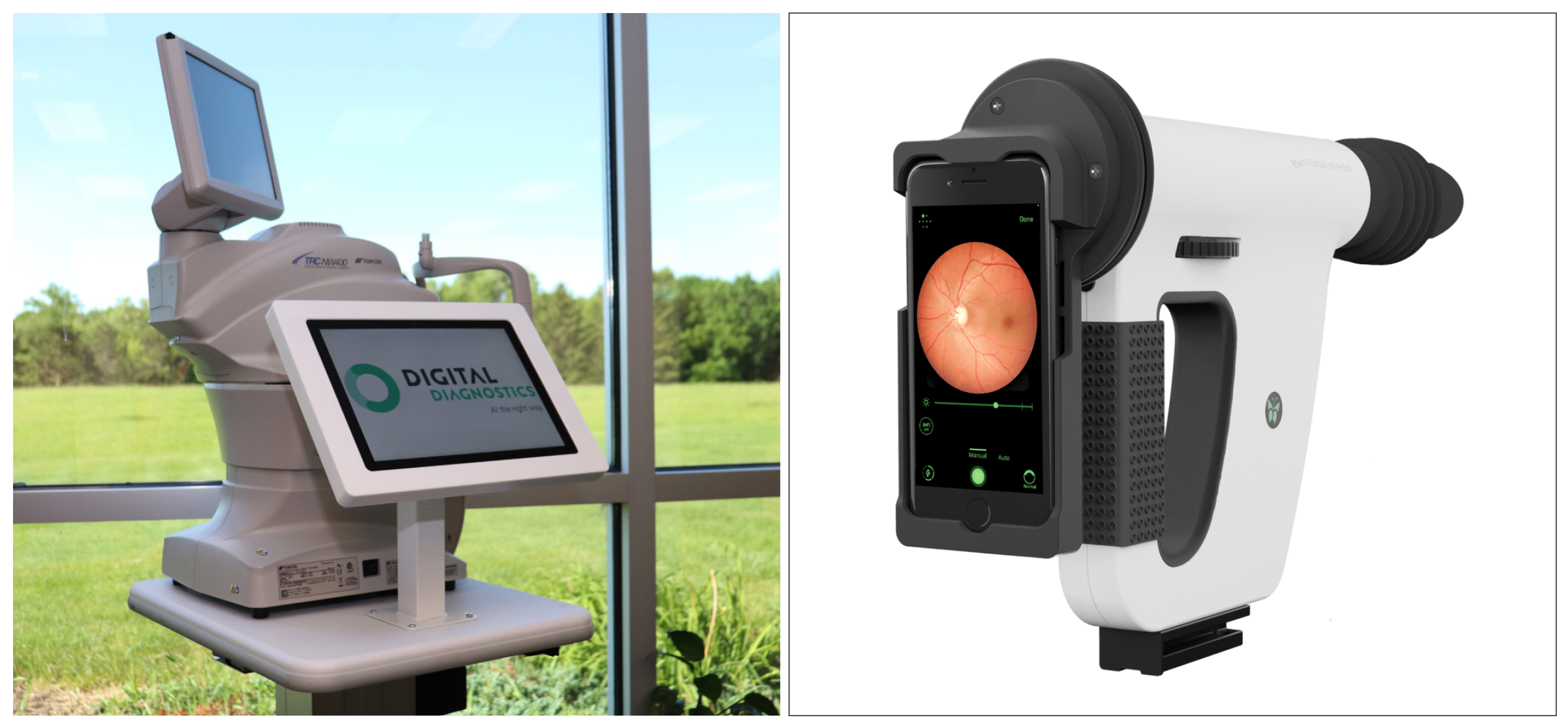 Automated DR image assessment software grade fundus images, either instead of or alongside human graders. In this study, the IDx-DR (left) exceeded the sensitivity measures of the Medios AI (right) at the cost of lower specificity.