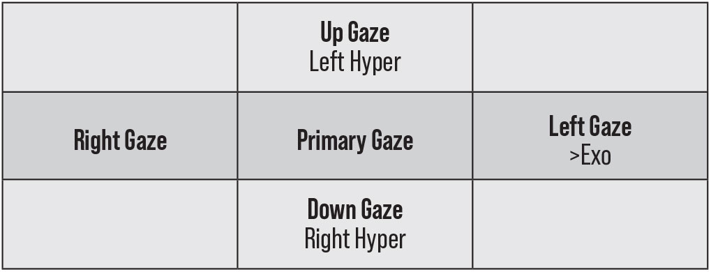 Fig. 5. This represents a pattern of right CN III palsy. There is a left hyper-deviation in up gaze with a right hyper-deviation in down gaze. This is representative of a reversing hyper-deviation. There is also an increasing exodeviation in left gaze. The opposite would be true of a left CN III palsy.