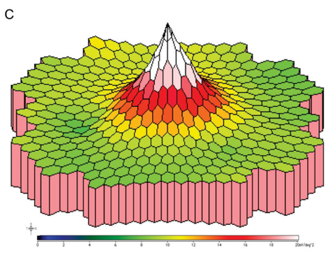 A reliable way to preoperatively assess the fundus and detect related disease in patients with turbid lenses is with full-field electroretinogram and multifocal electroretinogram (pictured: mfERG three-dimensional P1 response density plot).