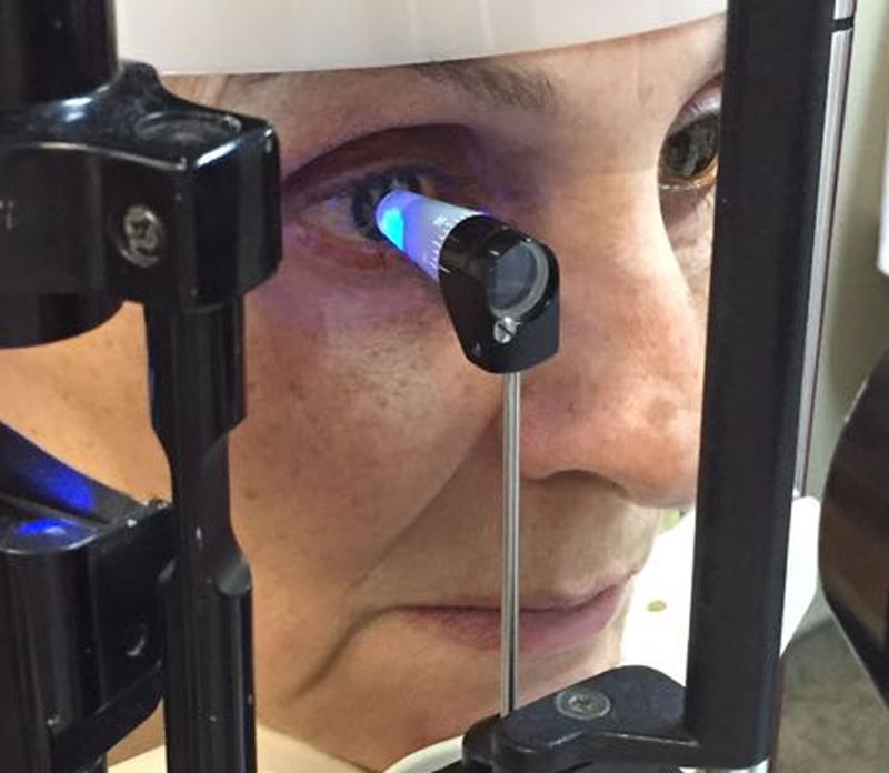 Not only does time of day affect intraocular pressure, but so does the day of the week, as shown in a new study. 