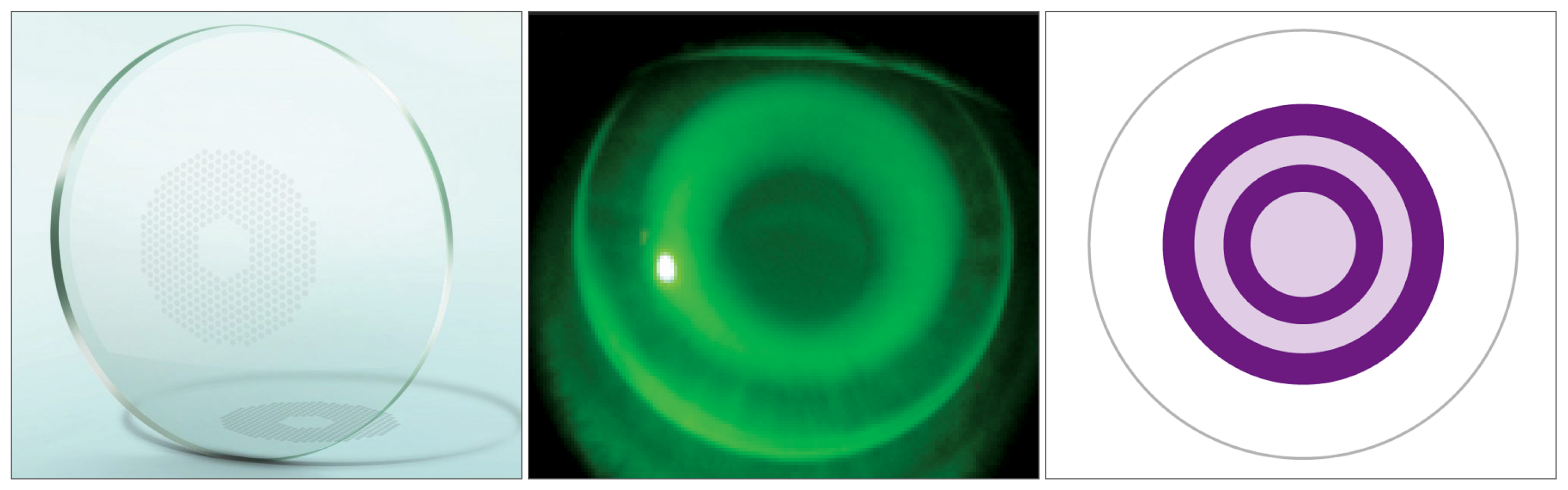 Lens-based myopia interventions seem to produce less rebound effect than others. However, many factors are at play in an individual response to any myopia mitigation strategy.