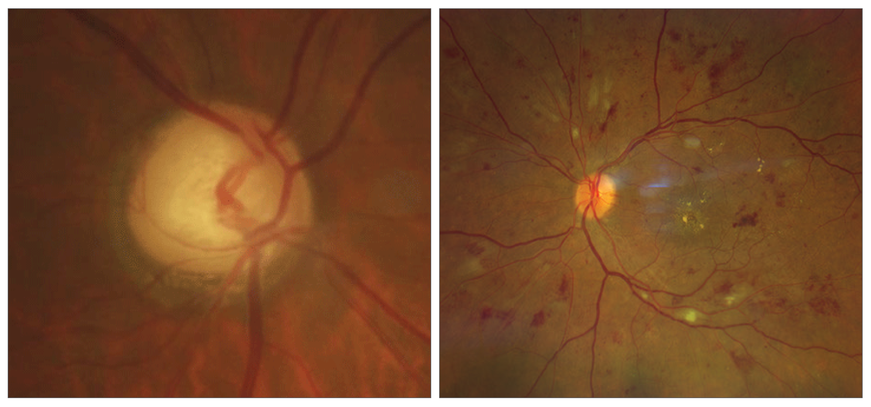 Common and well-known pathologies like glaucoma or diabetic retinopathy were more likely to display accurate and complete information. 