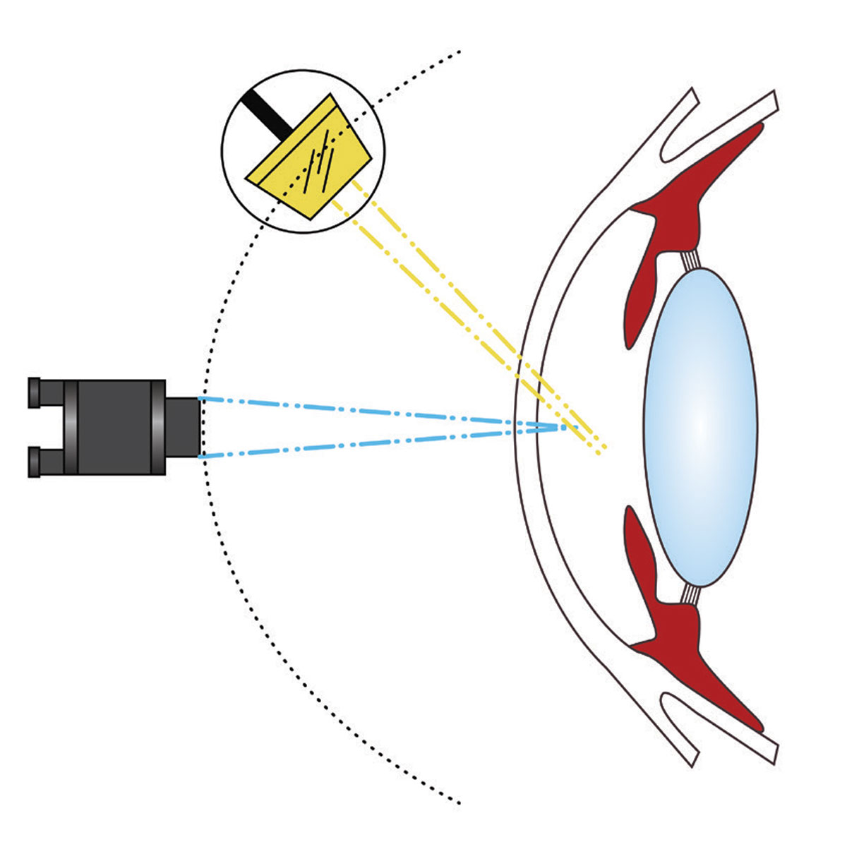 Fig. 8. An example of a conical beam. This light source is generated by reducing the vertical height of a papllelepiped to create a small circular or square spot of light.