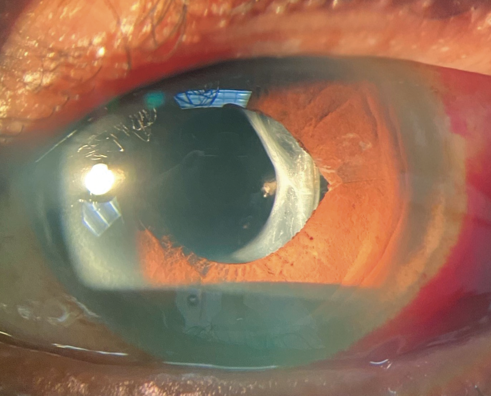 This is the patient’s presentation. What does it tell you about the potential etiology?