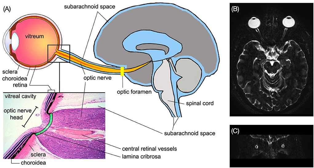 Recent evidence points to CSF dynamics becoming impaired with age, which plays a crucial role in brain health in older individuals.