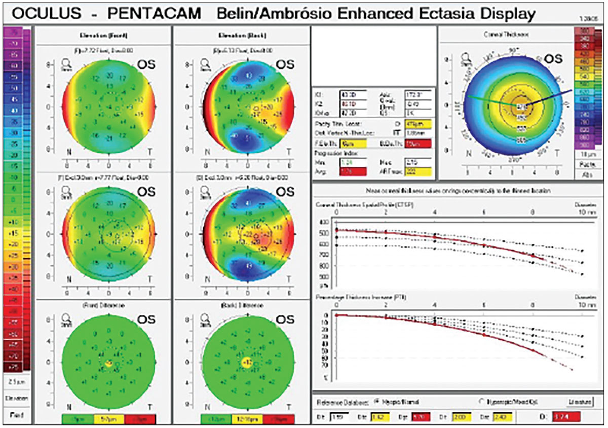 Fig. 4. While the top two maps on the left show the standard and exclusion elevation maps that are used used to show the front and back elevation maps in relation to their best fit sphere., Tthe bottom two maps show the elevation differences between front and back surface and will flag areas that are suspicious for greater differences than the norm.