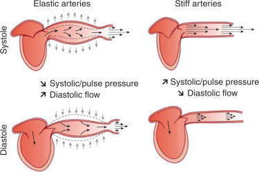 Arterial stiffness measured, with a specially equipped blood pressure cuff, predicted the development of glaucoma and could potentially be used in clinical practice, this research suggests.