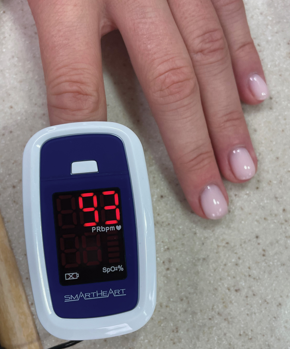 Pulse rate can be measured using a pulse oximeter, smartwatch, smartphone app or manually in-office.