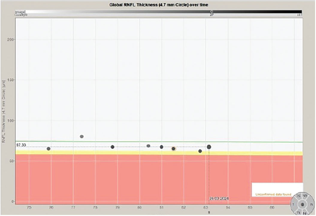 Fig. 4. Stability of the 4.7mm RNFL scan over an 8.5-year period.