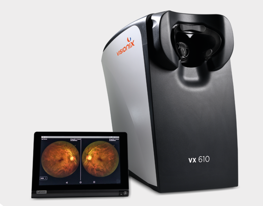 The VX 610 non-mydriatic automated fundus camera is now available, featuring a touch-screen interface and compact size.